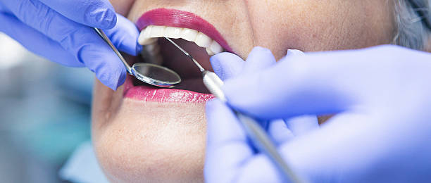 Best Knocked-Out Tooth (Avulsed Tooth) Treatment in Branchville, SC